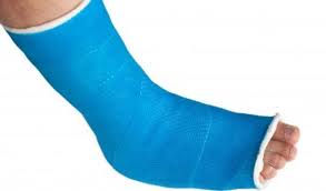 "Grote toename van aantal botbreuken door osteoporose".