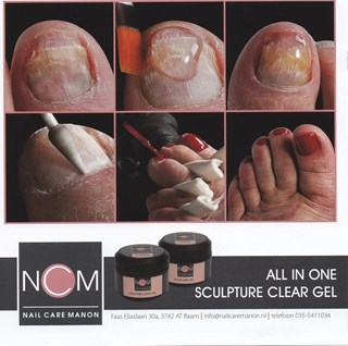 IMG_20170322_0002 NCM nagelreparatie 1