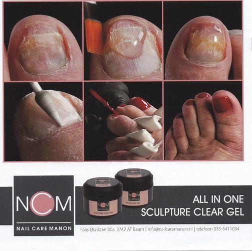 IMG_20170322_0002 NCM nagelreparatie 1